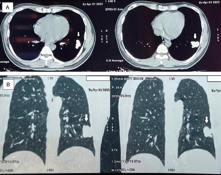 https://cdn.ncbi.nlm.nih.gov/pmc/blobs/461d/10783418/a645eca44895/ms9-86-580-g001.jpg
