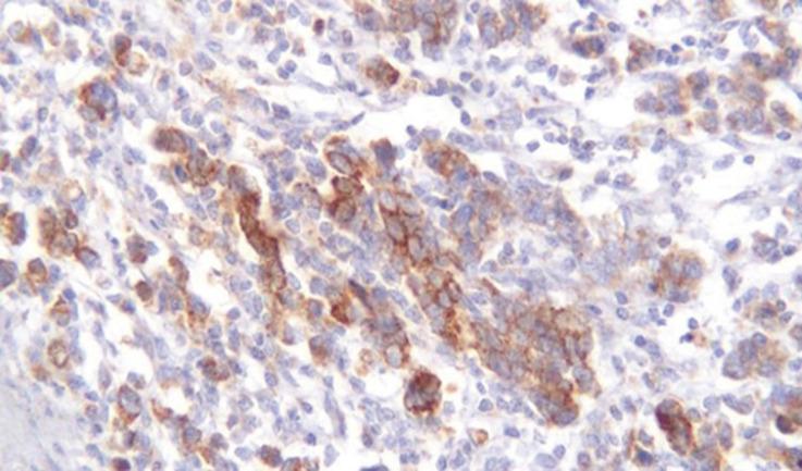 https://cdn.ncbi.nlm.nih.gov/pmc/blobs/4622/9375601/e2fb5af957fd/APJCP-23-1433-g005.jpg