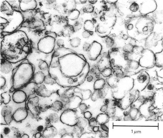 https://cdn.ncbi.nlm.nih.gov/pmc/blobs/4624/1161517/93b266eac753/biochemj00429-0187-a.jpg
