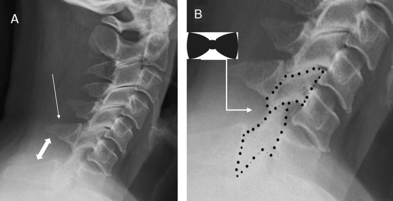 https://cdn.ncbi.nlm.nih.gov/pmc/blobs/4627/7894363/982146455bf0/jbsr-105-1-2314-g1.jpg