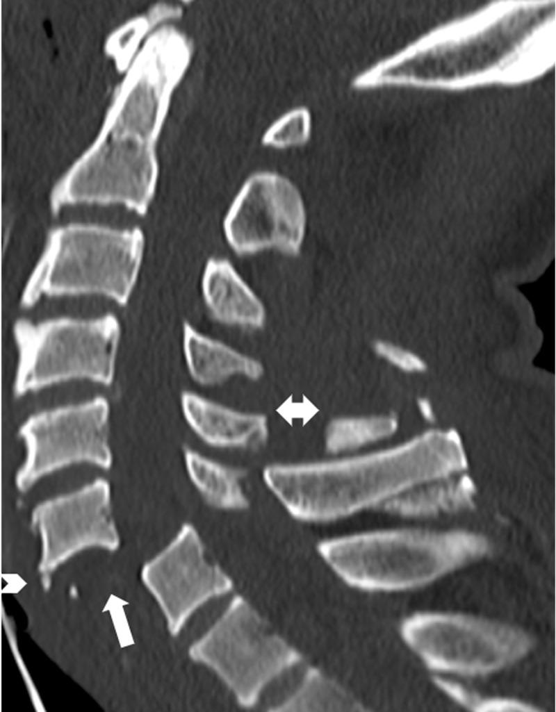 https://cdn.ncbi.nlm.nih.gov/pmc/blobs/4627/7894363/a974fa7f51fb/jbsr-105-1-2314-g2.jpg