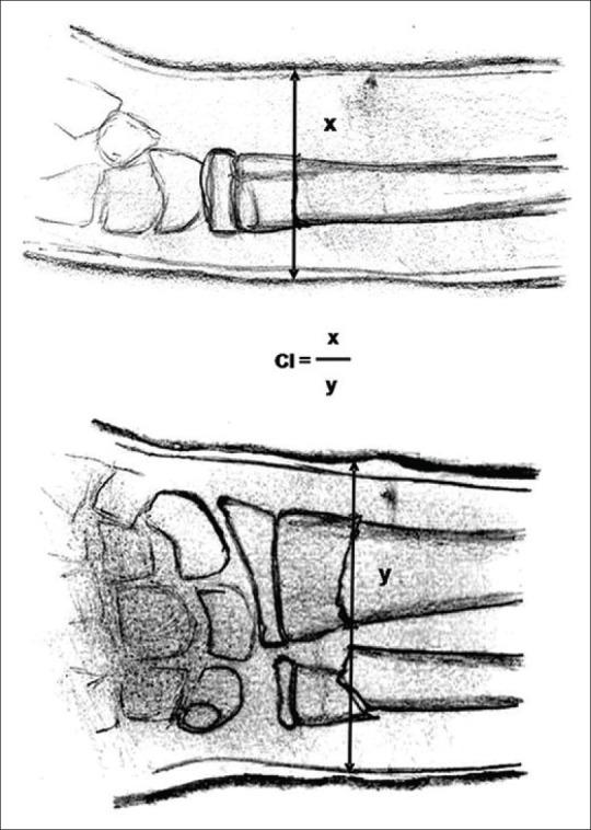 https://cdn.ncbi.nlm.nih.gov/pmc/blobs/462b/6142794/e52760db30c1/IJOrtho-52-536-g005.jpg