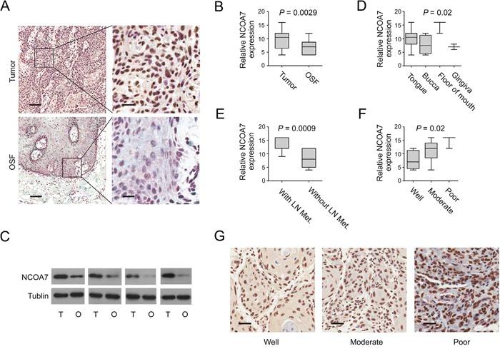 https://cdn.ncbi.nlm.nih.gov/pmc/blobs/462f/5312364/1fd6940a1fed/oncotarget-07-59987-g004.jpg