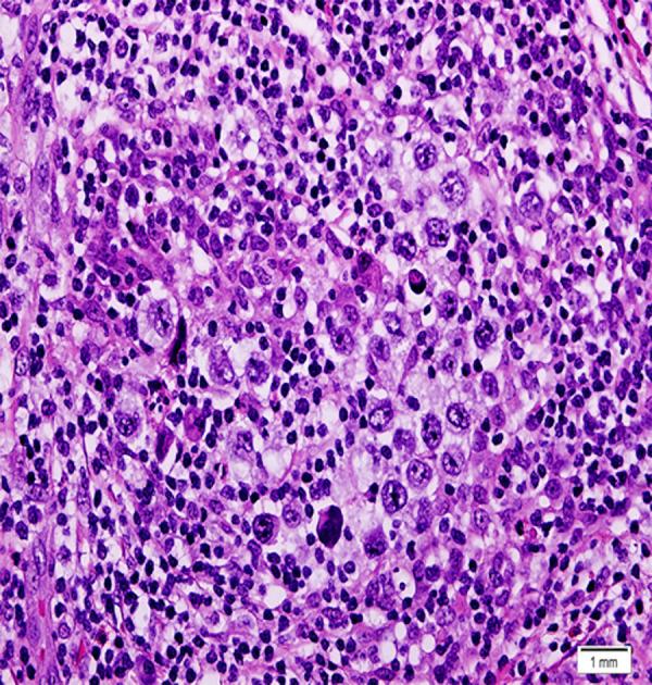 https://cdn.ncbi.nlm.nih.gov/pmc/blobs/4631/10687740/b0ed5d8e76b6/amjcaserep-24-e941792-g006.jpg