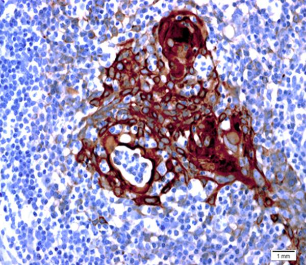 https://cdn.ncbi.nlm.nih.gov/pmc/blobs/4631/10687740/b640b48f0bf5/amjcaserep-24-e941792-g011.jpg