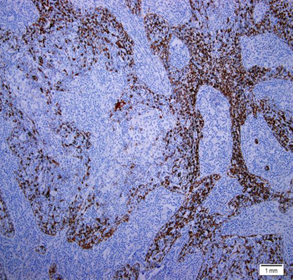 https://cdn.ncbi.nlm.nih.gov/pmc/blobs/4631/10687740/c5ea9f174169/amjcaserep-24-e941792-g010.jpg