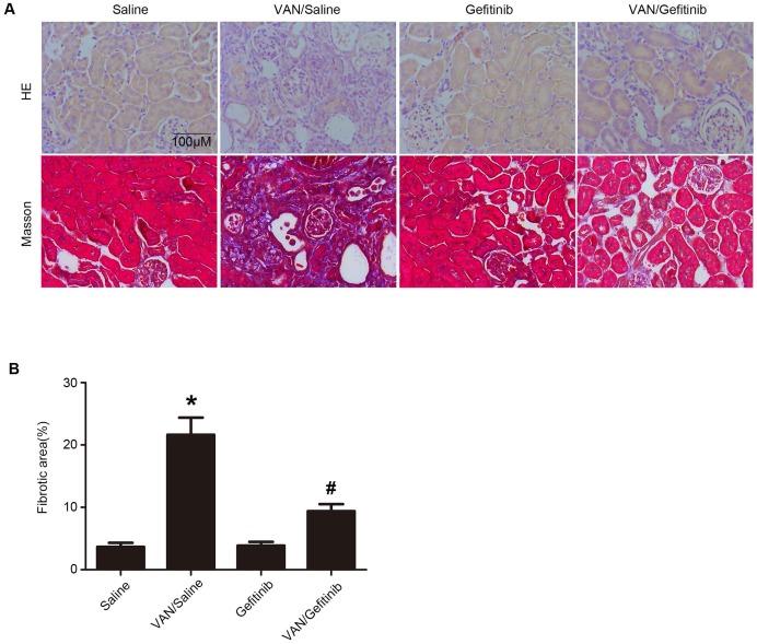 https://cdn.ncbi.nlm.nih.gov/pmc/blobs/4631/6526000/fe7ea773de28/thnov09p2712g009.jpg