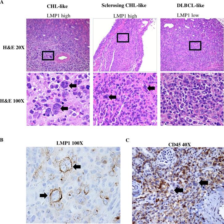 https://cdn.ncbi.nlm.nih.gov/pmc/blobs/4631/7316346/23d71a6f69fe/ppat.1008590.g006.jpg