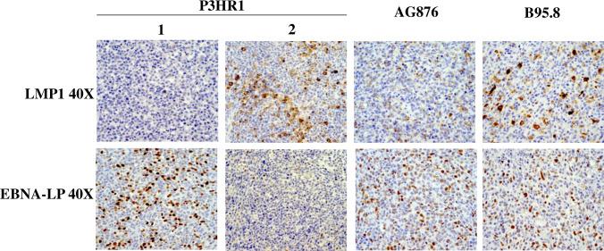 https://cdn.ncbi.nlm.nih.gov/pmc/blobs/4631/7316346/49c8e64670b0/ppat.1008590.g003.jpg