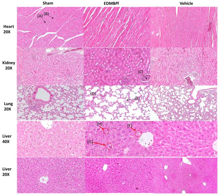 https://cdn.ncbi.nlm.nih.gov/pmc/blobs/4636/12195861/5b936420ae92/pharmaceuticals-18-00881-g012.jpg