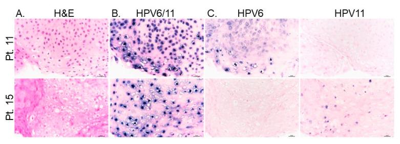 https://cdn.ncbi.nlm.nih.gov/pmc/blobs/4646/8197133/25850a34d9e0/cancers-13-02556-g006.jpg