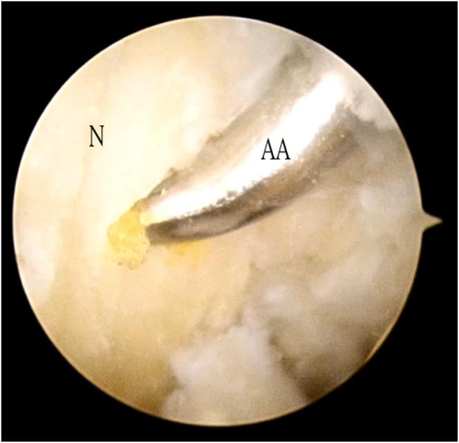 https://cdn.ncbi.nlm.nih.gov/pmc/blobs/4649/11369957/a939e9398163/gr9.jpg