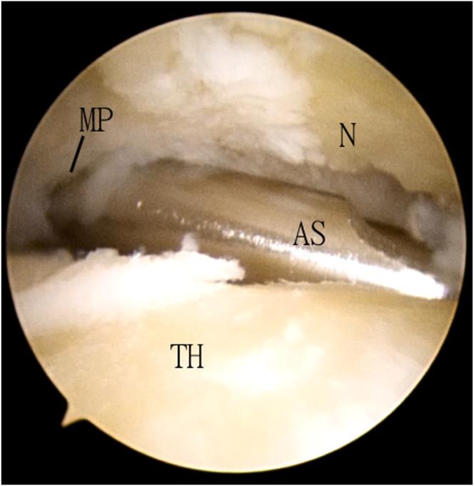 https://cdn.ncbi.nlm.nih.gov/pmc/blobs/4649/11369957/af130f9e4880/gr5.jpg