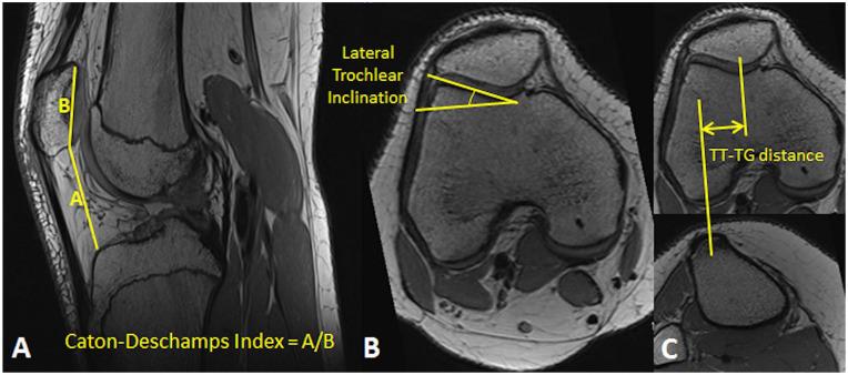 https://cdn.ncbi.nlm.nih.gov/pmc/blobs/4649/9189536/1461563f9602/10.1177_19476035221102570-fig1.jpg