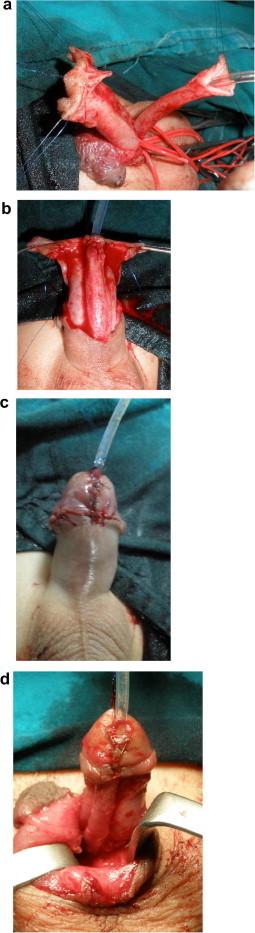 https://cdn.ncbi.nlm.nih.gov/pmc/blobs/4654/4442919/52f83f8d6945/gr2.jpg