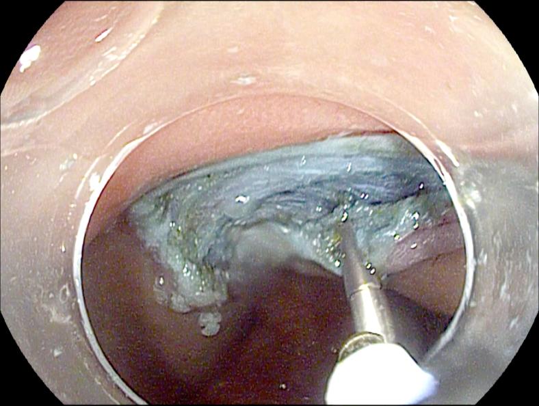https://cdn.ncbi.nlm.nih.gov/pmc/blobs/4657/7482364/c75e4aebcad9/gr3.jpg