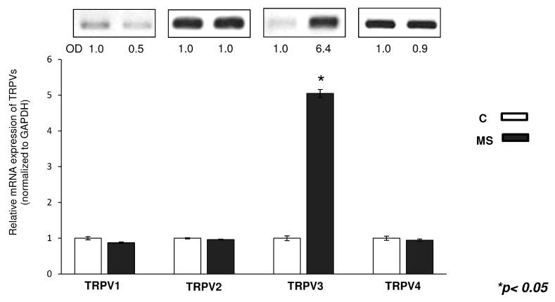 https://cdn.ncbi.nlm.nih.gov/pmc/blobs/4659/4581253/0617a5f55143/ijms-16-18412-g006.jpg