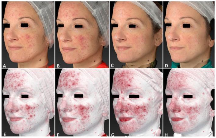 https://cdn.ncbi.nlm.nih.gov/pmc/blobs/465b/10970793/422b2d9c4b6b/jcm-13-01646-g012.jpg