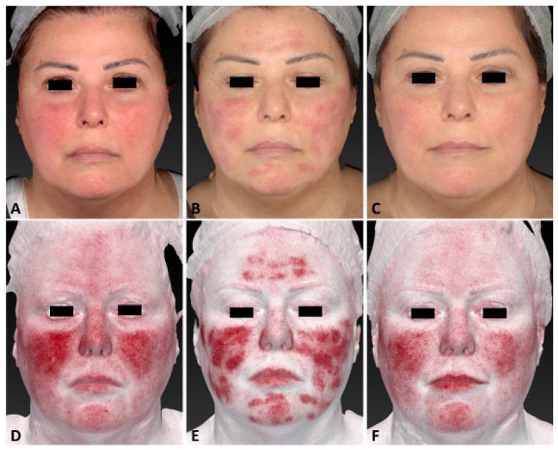https://cdn.ncbi.nlm.nih.gov/pmc/blobs/465b/10970793/622d1e5b1488/jcm-13-01646-g002.jpg