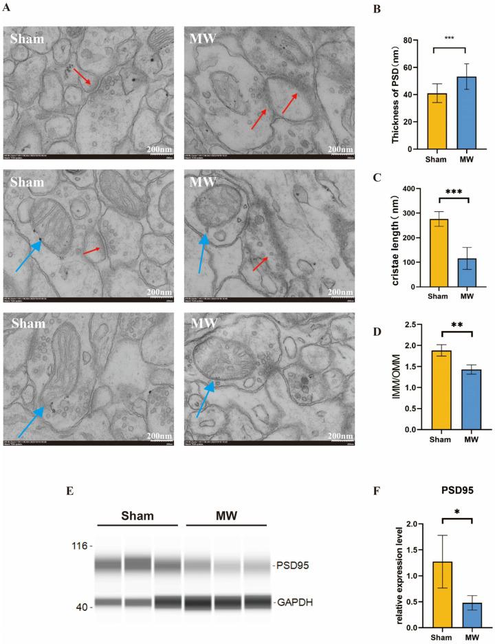 https://cdn.ncbi.nlm.nih.gov/pmc/blobs/465f/11118611/fd691f7910ac/brainsci-14-00441-g003.jpg