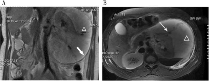 https://cdn.ncbi.nlm.nih.gov/pmc/blobs/4666/6921490/06e05c0eb2ea/12884_2019_2669_Fig1_HTML.jpg