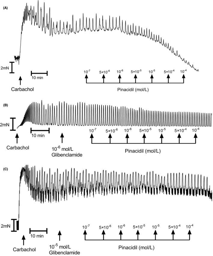 https://cdn.ncbi.nlm.nih.gov/pmc/blobs/4671/8365708/e797690cc22a/NMO-33-e14093-g005.jpg