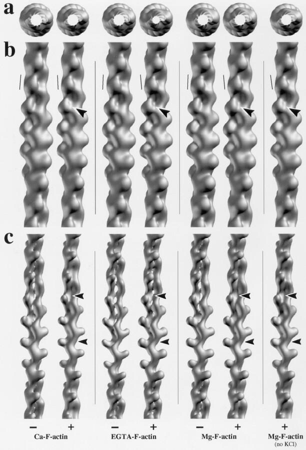 https://cdn.ncbi.nlm.nih.gov/pmc/blobs/4677/2141646/147855493b06/JCB.10847f8.jpg