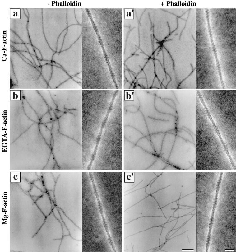 https://cdn.ncbi.nlm.nih.gov/pmc/blobs/4677/2141646/7694d634aa2d/JCB.10847f5.jpg