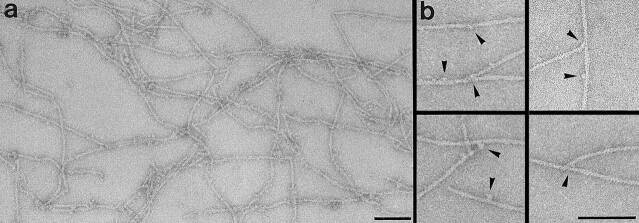 https://cdn.ncbi.nlm.nih.gov/pmc/blobs/4677/2141646/a74d2114d48a/JCB.10847f4.jpg