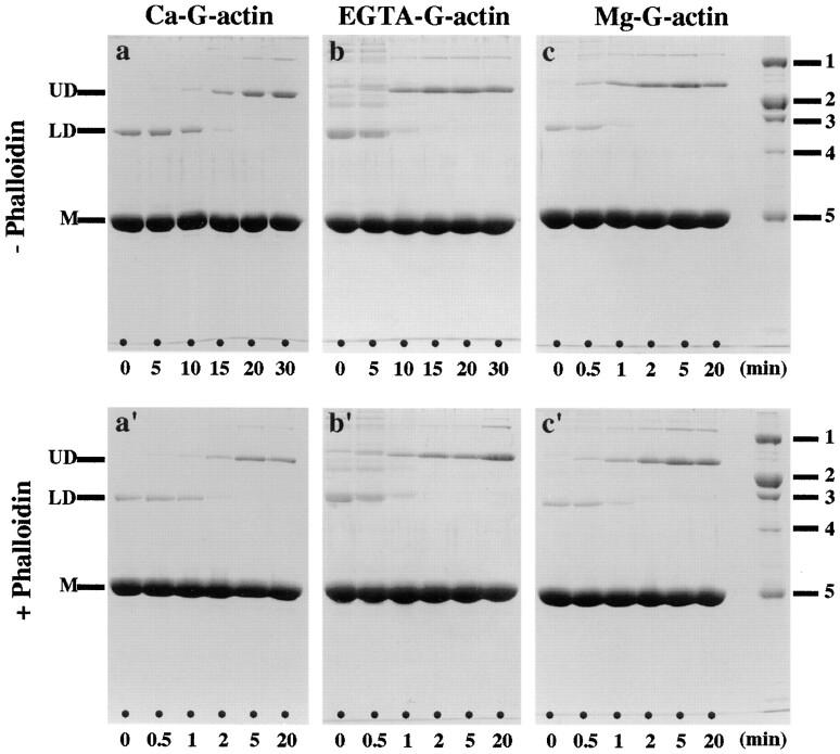 https://cdn.ncbi.nlm.nih.gov/pmc/blobs/4677/2141646/ab2ec7e360b0/JCB.10847f2.jpg