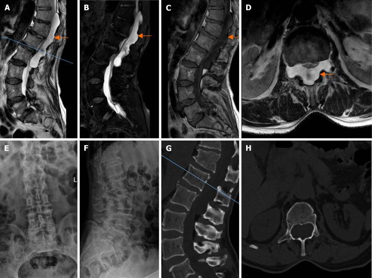 https://cdn.ncbi.nlm.nih.gov/pmc/blobs/4679/11263048/f66928608b5d/WJCC-12-5798-g001.jpg