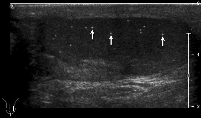 https://cdn.ncbi.nlm.nih.gov/pmc/blobs/467e/3424905/2a26dd49f7f5/IJU-28-211-g002.jpg