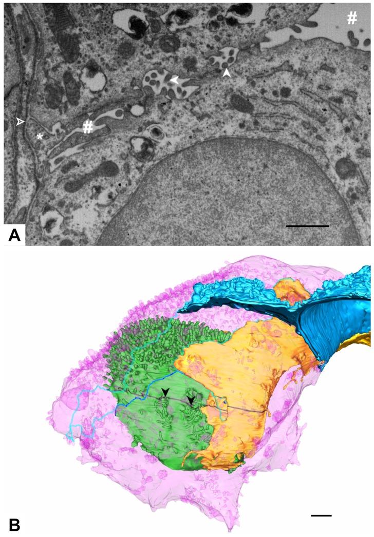 https://cdn.ncbi.nlm.nih.gov/pmc/blobs/467f/7038159/1f0a8e9d44ff/ijms-21-01089-g012.jpg