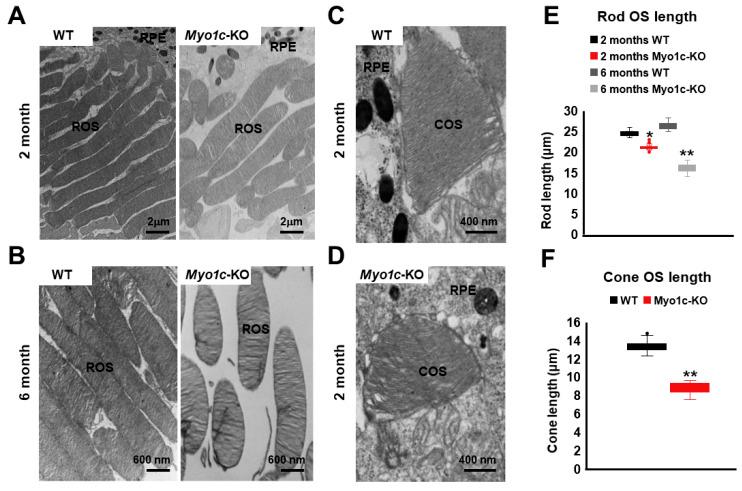 https://cdn.ncbi.nlm.nih.gov/pmc/blobs/4685/8229726/c5c5a1403267/cells-10-01322-g006.jpg