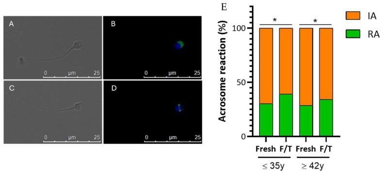 https://cdn.ncbi.nlm.nih.gov/pmc/blobs/4688/11011712/645808437591/cells-13-00625-g005.jpg