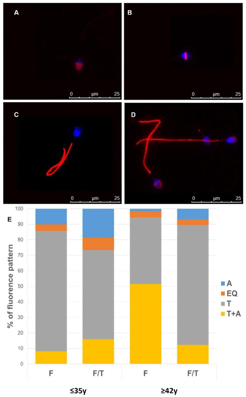 https://cdn.ncbi.nlm.nih.gov/pmc/blobs/4688/11011712/9bd68f1b4b03/cells-13-00625-g007.jpg