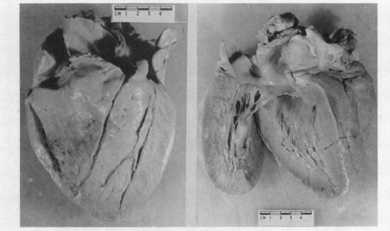 https://cdn.ncbi.nlm.nih.gov/pmc/blobs/468e/479602/517a933f92a2/brheartj00385-0110-a.jpg