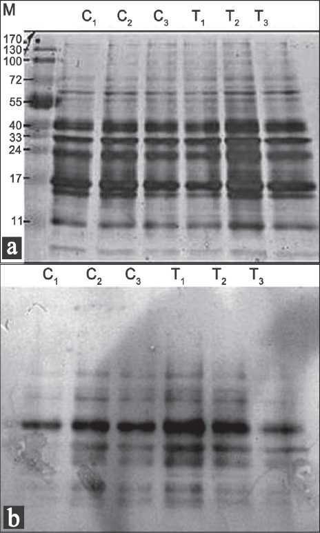 https://cdn.ncbi.nlm.nih.gov/pmc/blobs/4694/3217288/a6f3ba9136f9/JNSBM-1-16-g002.jpg