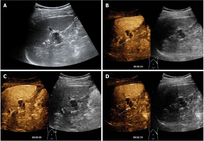 https://cdn.ncbi.nlm.nih.gov/pmc/blobs/4696/8891771/bbb6823eed82/WJCC-10-1973-g001.jpg