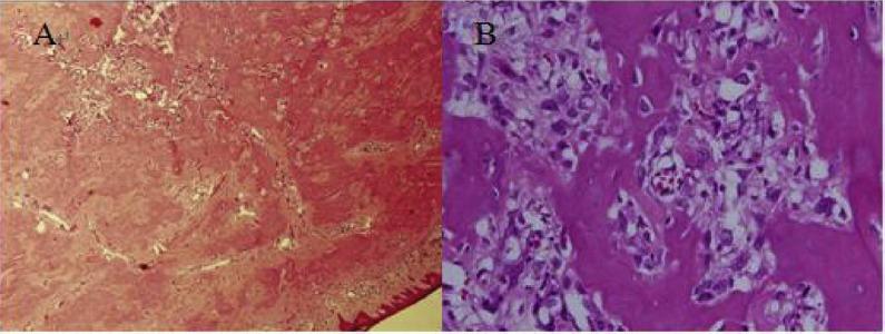 https://cdn.ncbi.nlm.nih.gov/pmc/blobs/4697/5509176/f048259c0d50/TCMJ-28-35-g002.jpg