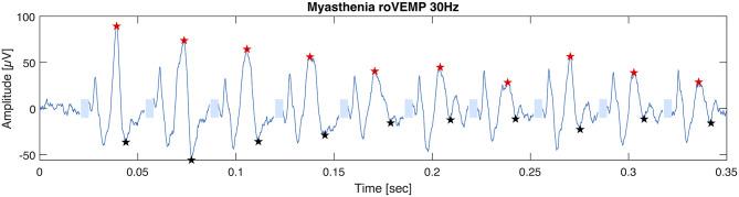 https://cdn.ncbi.nlm.nih.gov/pmc/blobs/469b/7438439/631dc96eff92/fneur-11-00861-g0002.jpg