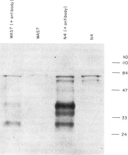 https://cdn.ncbi.nlm.nih.gov/pmc/blobs/469d/1554645/ebc8549fff04/clinexpimmunol00039-0049-b.jpg