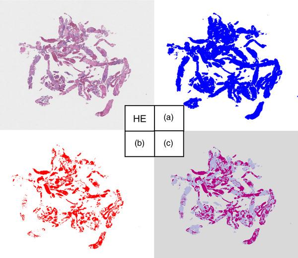 https://cdn.ncbi.nlm.nih.gov/pmc/blobs/469e/12064553/b1cca53c5cd2/DEO2-6-e70104-g003.jpg