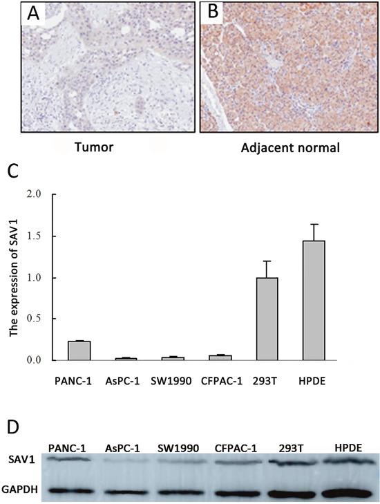 https://cdn.ncbi.nlm.nih.gov/pmc/blobs/46a7/5609894/331a6a784533/oncotarget-08-62953-g001.jpg