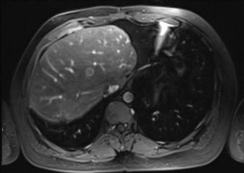 https://cdn.ncbi.nlm.nih.gov/pmc/blobs/46aa/7299906/0fa683eecedf/gr5.jpg