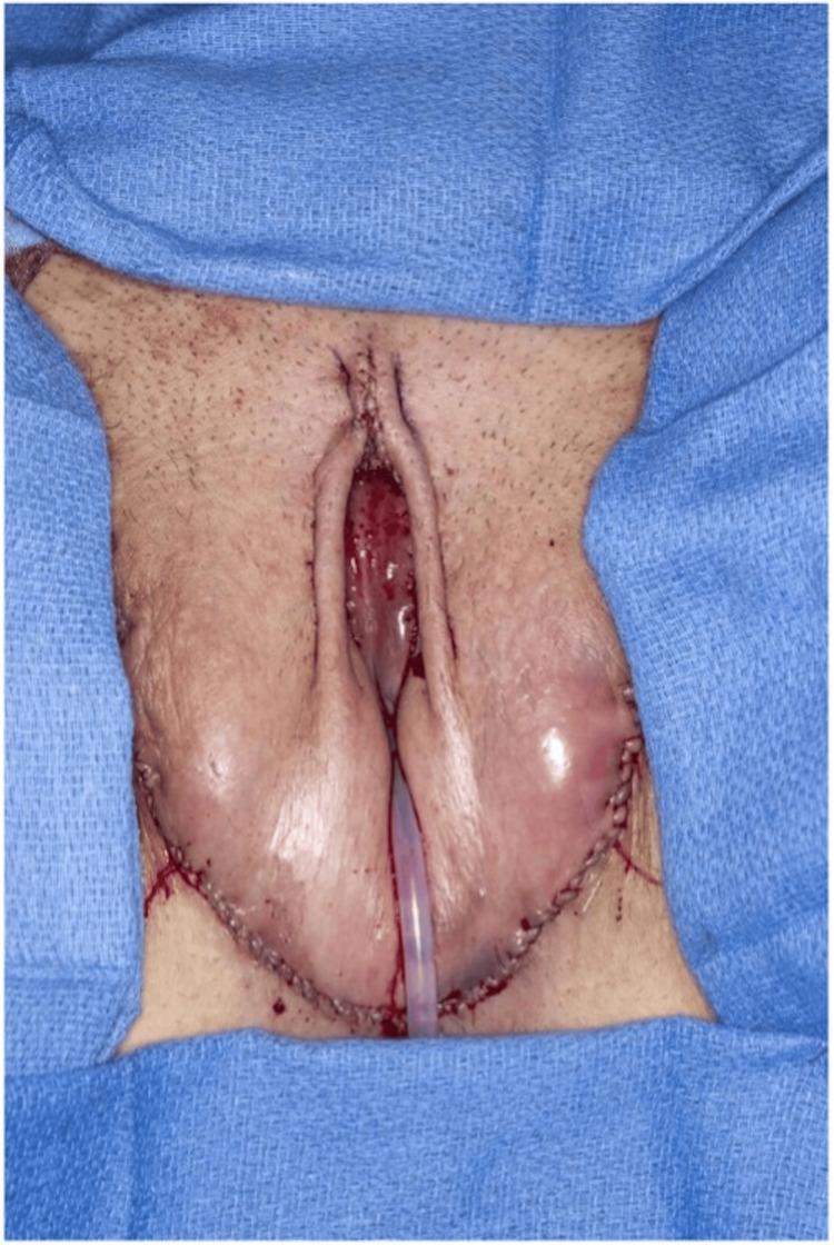 https://cdn.ncbi.nlm.nih.gov/pmc/blobs/46af/11463822/4922ce490770/cureus-0016-00000068949-i10.jpg