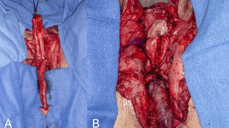 https://cdn.ncbi.nlm.nih.gov/pmc/blobs/46af/11463822/5e9e8f2b7017/cureus-0016-00000068949-i07.jpg
