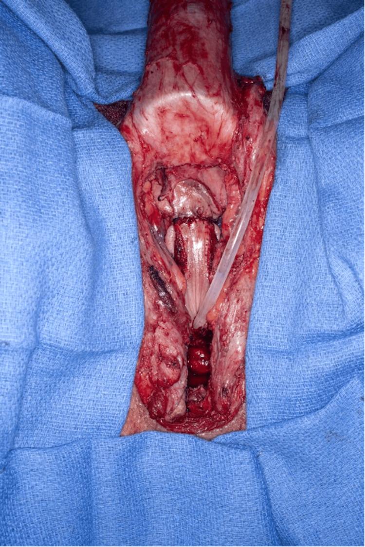 https://cdn.ncbi.nlm.nih.gov/pmc/blobs/46af/11463822/f6cbcddddb03/cureus-0016-00000068949-i08.jpg