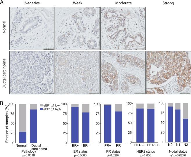 https://cdn.ncbi.nlm.nih.gov/pmc/blobs/46b1/6141510/78f9dbcb8876/41598_2018_32272_Fig4_HTML.jpg