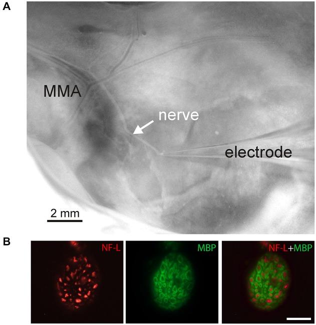 https://cdn.ncbi.nlm.nih.gov/pmc/blobs/46b2/4516892/45e533852317/fncel-09-00287-g0001.jpg